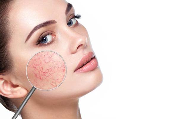 skin problems